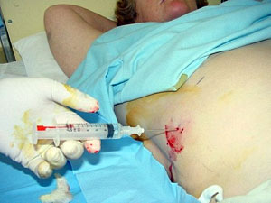 �������� ������� �������