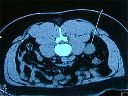 ������� ��� ���� �������