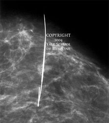 ��������������� �������